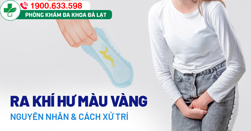 Ra nhiều khí hư màu vàng có phải là dấu hiệu bệnh lý ở phái nữ không?