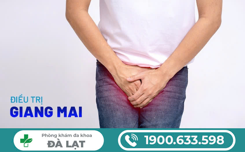 CÁCH ĐIỀU TRỊ GIANG MAI AN TOÀN HIỆU QUẢ VÀ NHỮNG LƯU Ý CẦN BIẾT