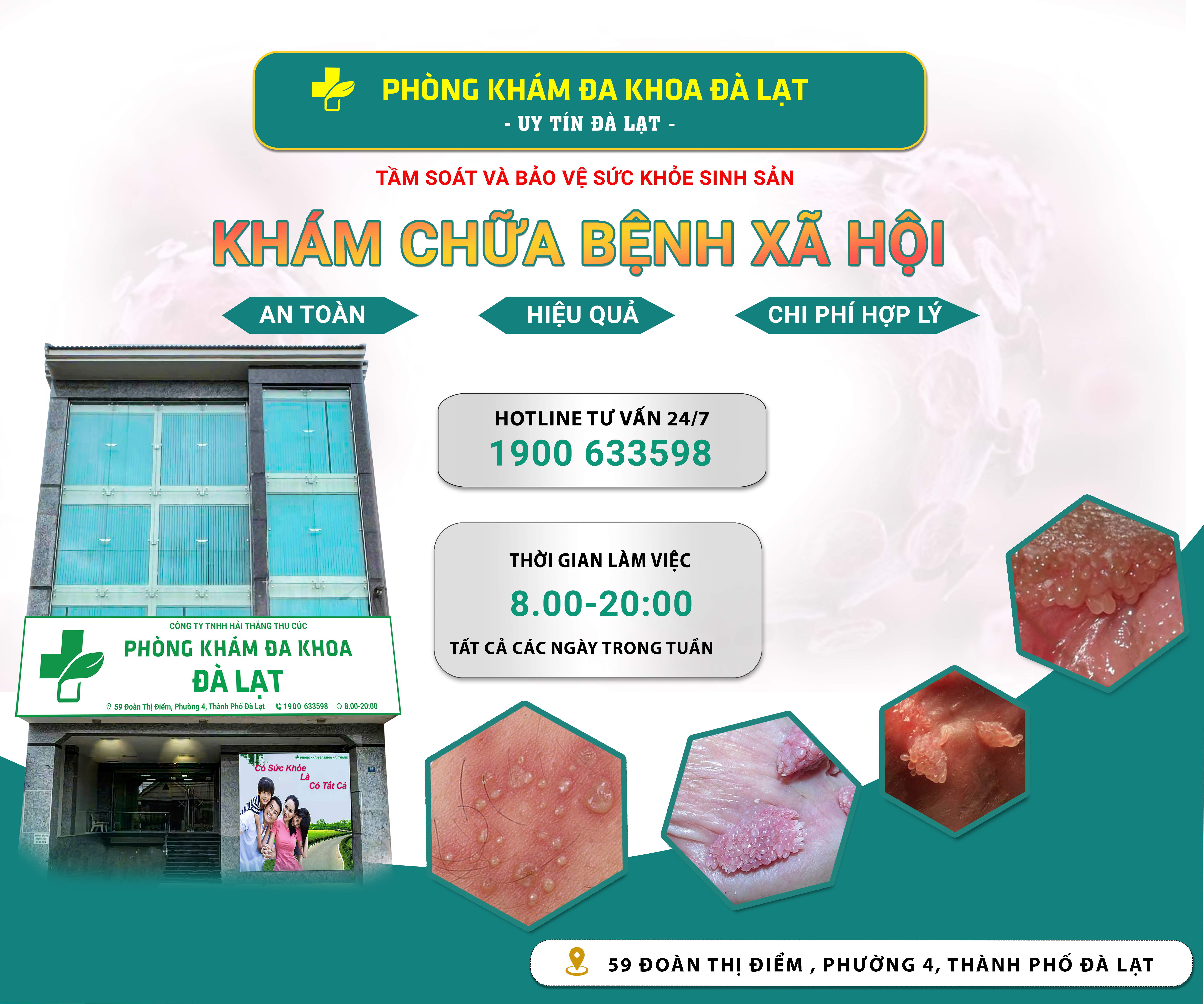 XÉT NGHIỆM GIANG MAI Ở ĐÂU UY TÍN?
