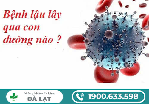 BỆNH LẬU CÓ LÂY KHÔNG? - NHỮNG CON ĐƯỜNG LÂY BỆNH