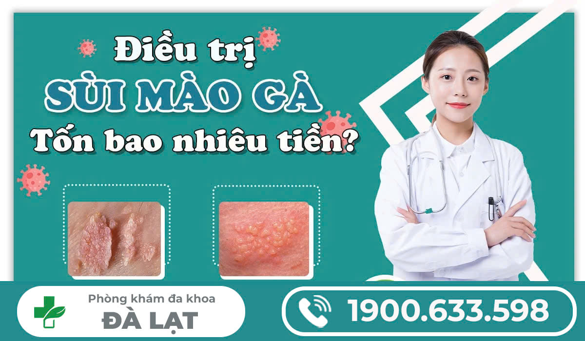 CHI PHÍ ĐIỀU TRỊ SÙI MÀO GÀ HẾT BAO NHIÊU?