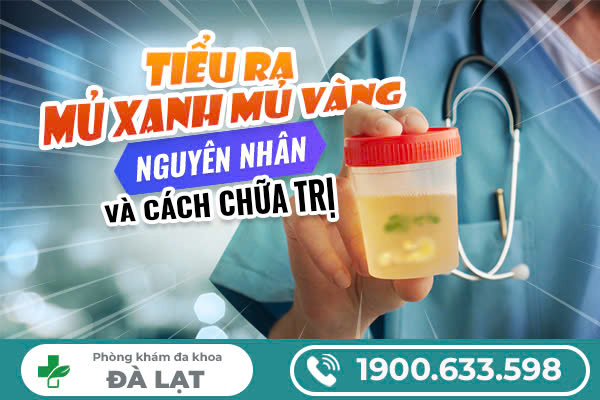 Bác Sĩ Chuyên Khoa Cảnh Báo: Tiểu Ra Mủ Vàng Nguy Cơ Mắc Bệnh Lậu Rất Cao – Đừng Chủ Quan