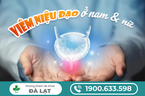 Viêm niệu đạo có mủ