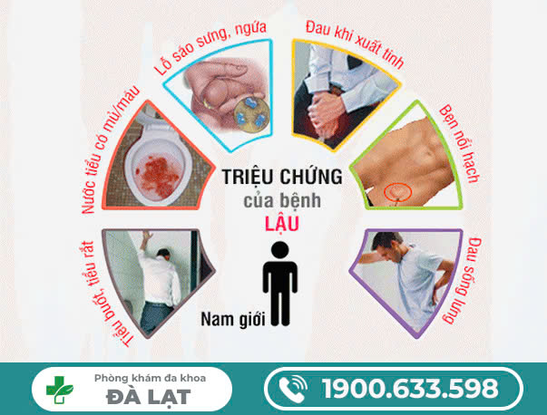 BỆNH LẬU Ở NAM GIỚI GIAI ĐOẠN ĐẦU