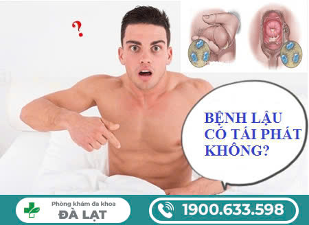 BỆNH LẬU CÓ TÁI PHÁT KHÔNG -  HIỂU ĐỂ ĐIỀU TRỊ CHO ĐÚNG