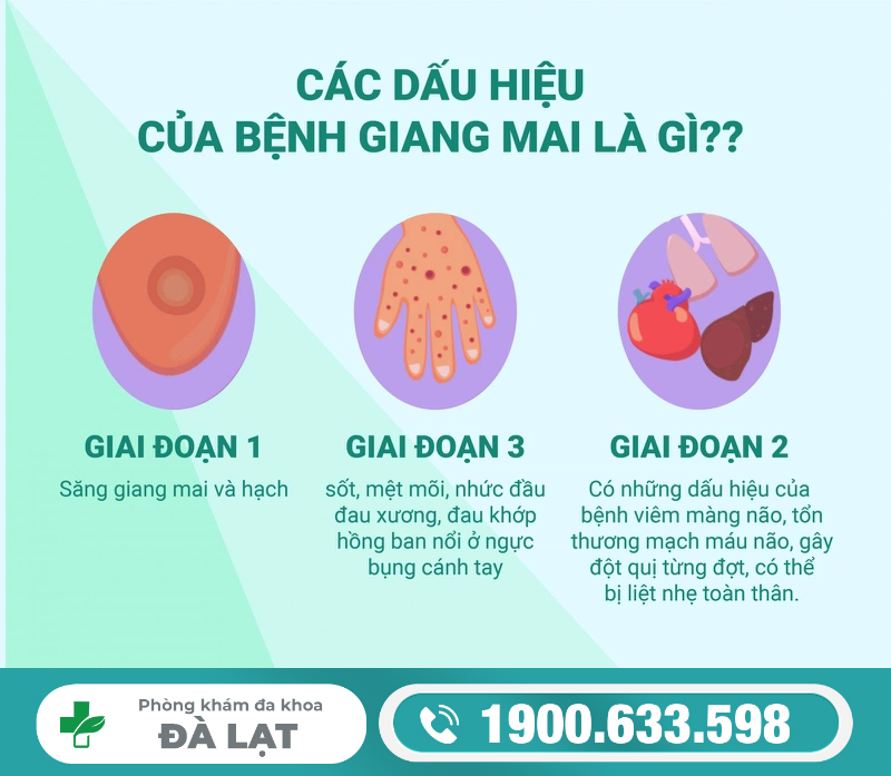 Nhận Biết Biểu Hiện Bệnh Giang Mai 