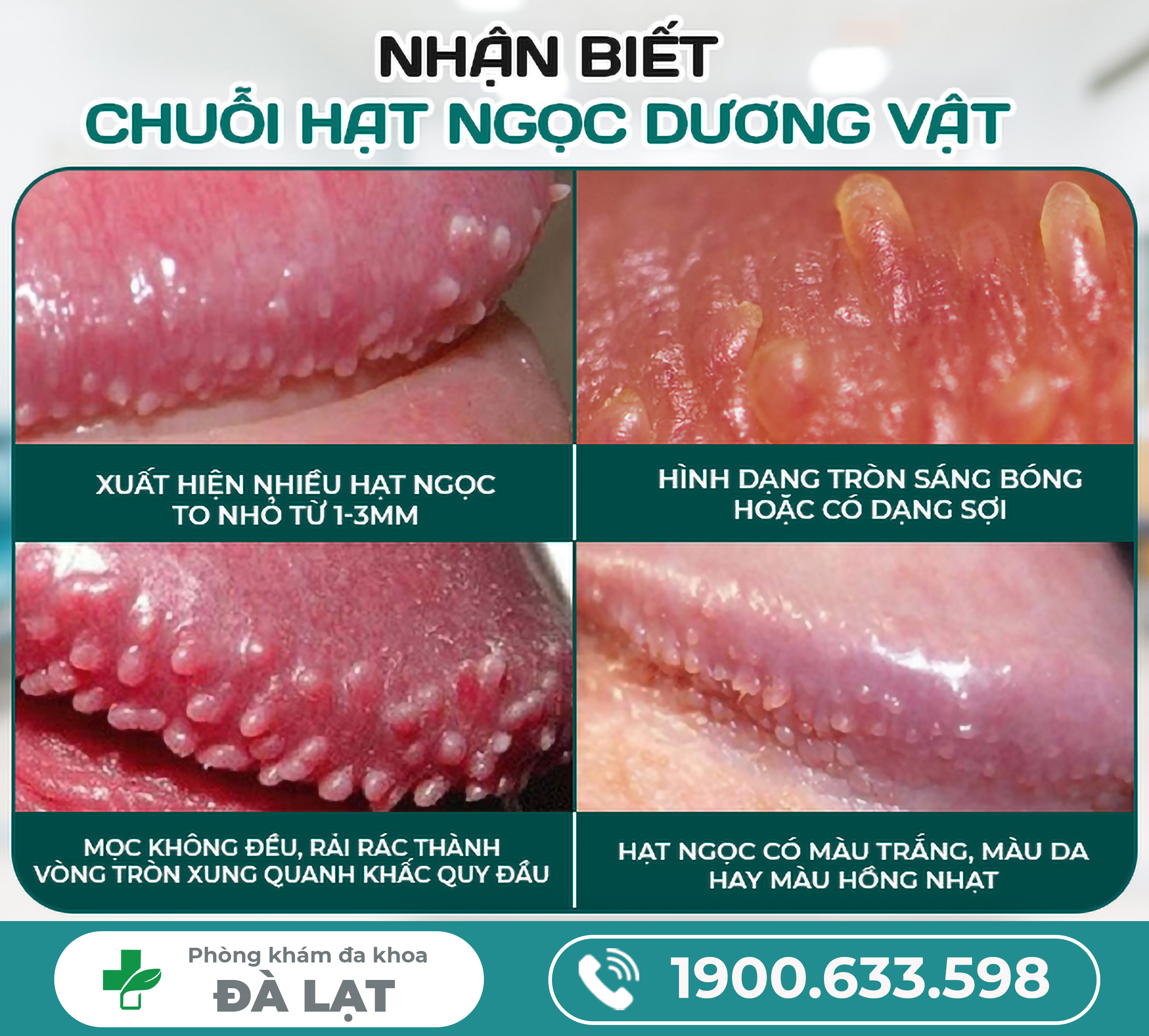 Hình Ảnh Về Chuỗi Hạt Ngọc Dương Vật 