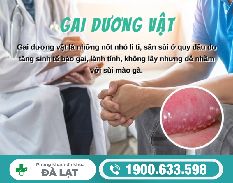 Tìm Hiểu Về: Gai Dương Vật 