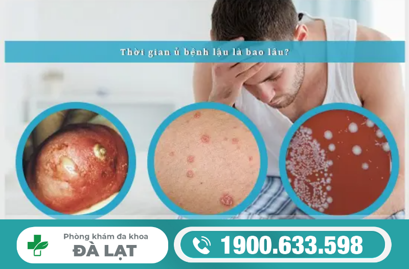 BÁC SĨ GIẢI ĐÁP: THỜI GIAN Ủ BỆNH LẬU Ở NỮ LÀ BAO LÂU?