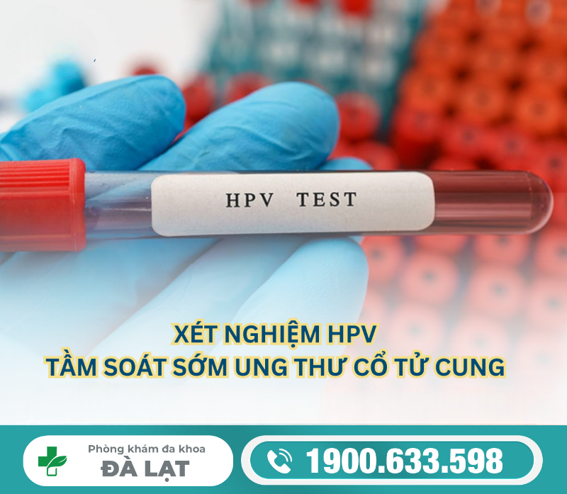 GIẢI ĐÁP: XÉT NGHIỆM BỆNH HPV Ở ĐÂU AN TOÀN VÀ UY TÍN?