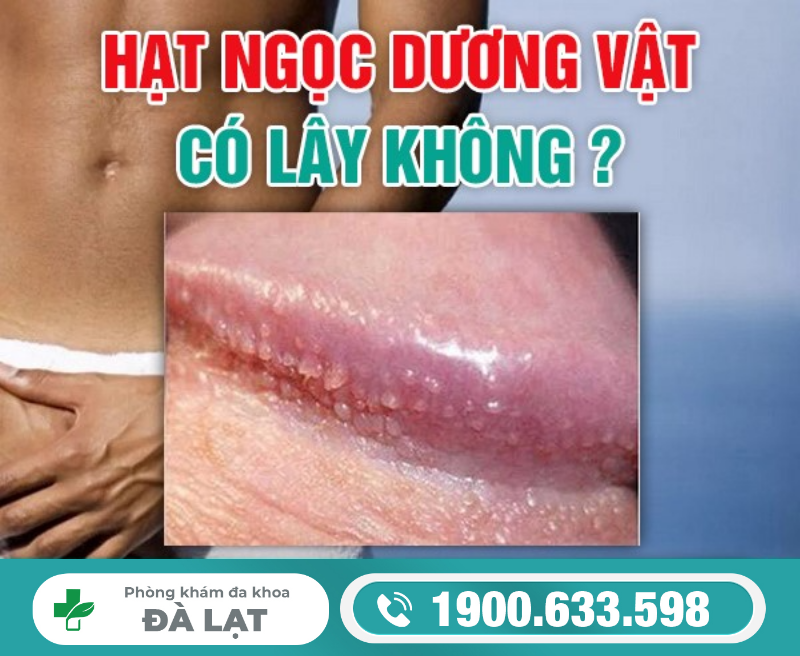 Hạt Ngọc Dương Vật Có Lây Không? 
