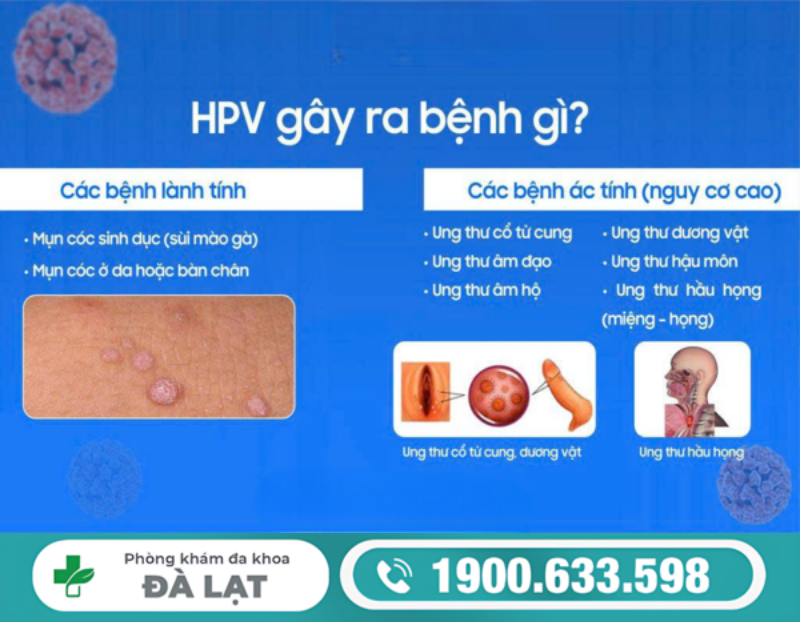 NHẬN BIẾT CÁC DẤU HIỆU BỊ NHIỄM HPV THƯỜNG GẶP