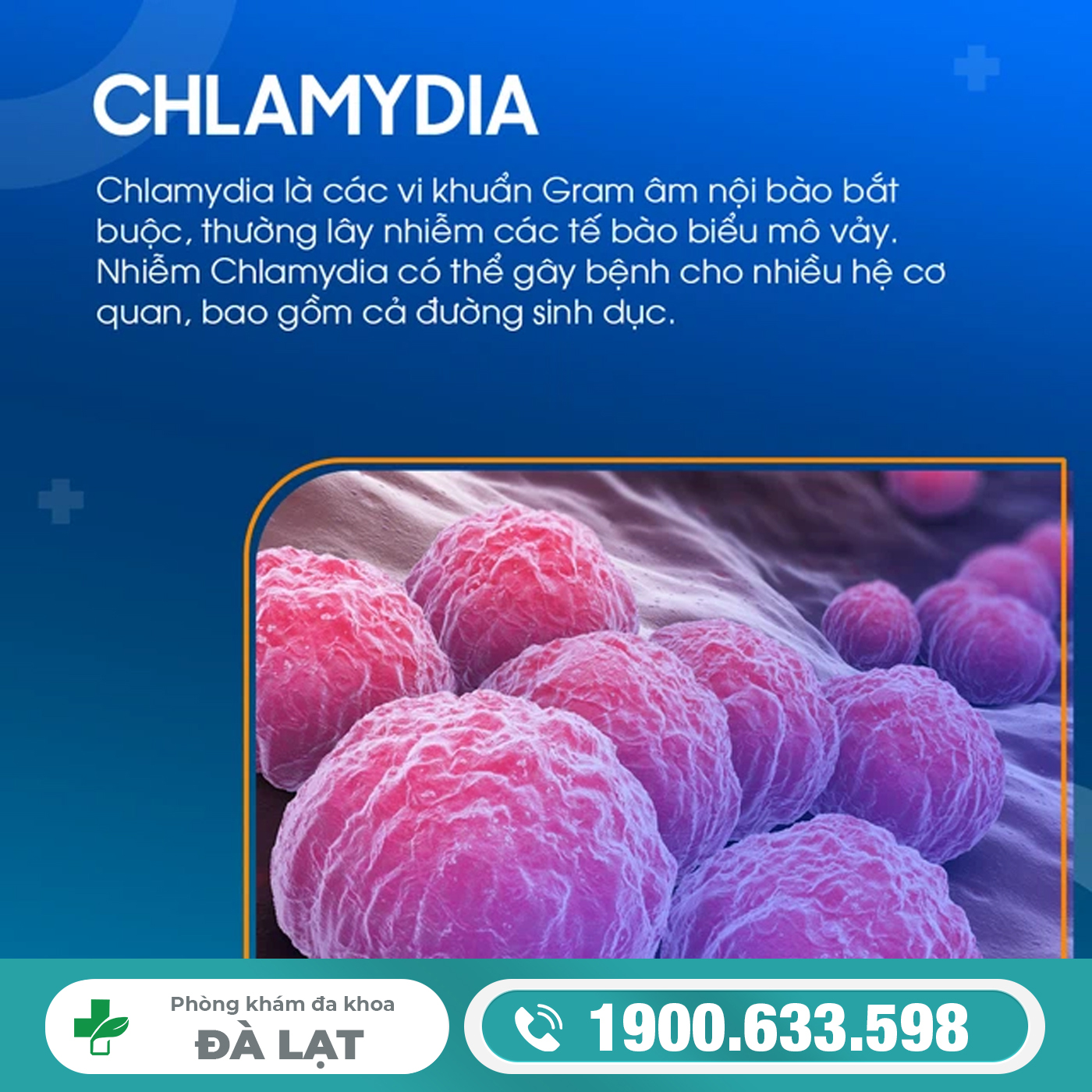 Dấu Hiệu Nhận Biết Bệnh Chlamydia 