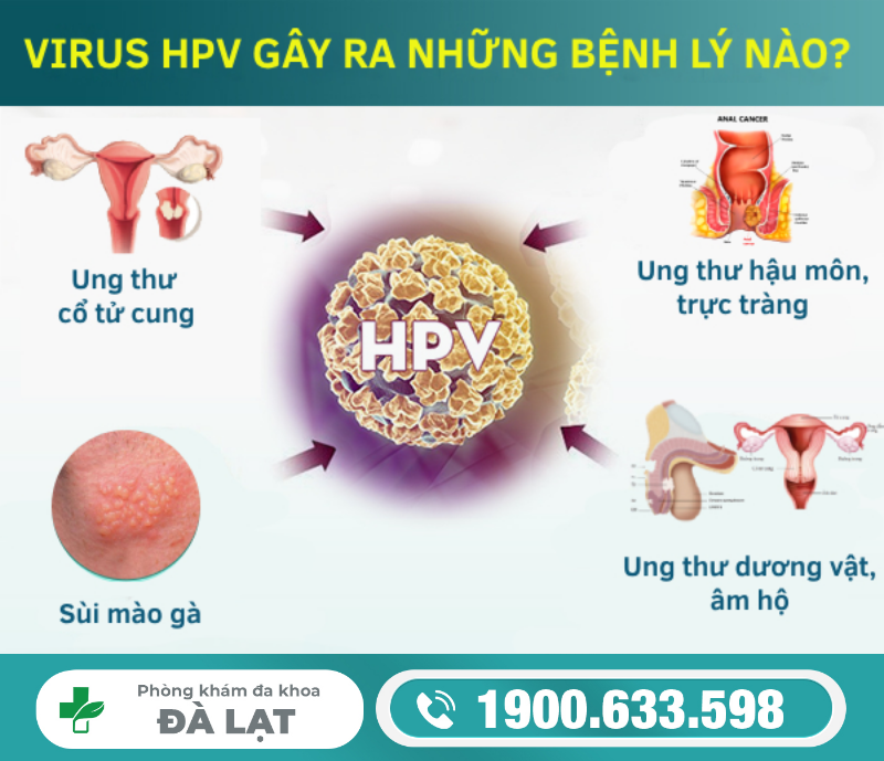 TÌM HIỂU CÁCH CHỮA HPV HIỆU QUẢ VÀ AN TOÀN