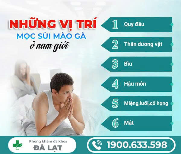 TÌM HIỂU BỆNH SÙI MÀO Ở ĐẦU KHẤC VÀ CÁCH ĐIỀU TRỊ 