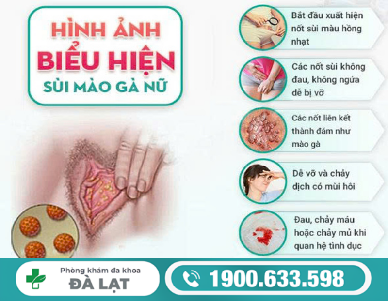 TÌM HIỂU VỀ BỆNH SÙI MÀO GÀ Ở MÔI CÔ BÉ 