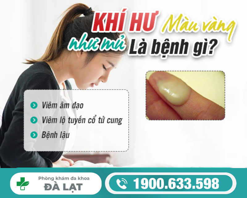 Khí Hư Màu Vàng Như Mủ Cảnh Báo Bệnh Gì? 